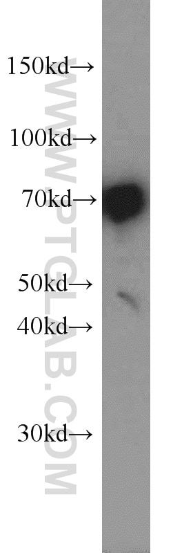 Western Blot (WB) analysis of HeLa cells using DNAJC2/MPP11 Polyclonal antibody (11971-1-AP)