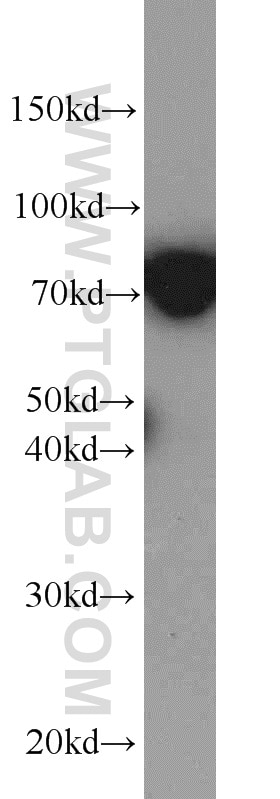 Western Blot (WB) analysis of K-562 cells using DNAJC2/MPP11 Polyclonal antibody (11971-1-AP)