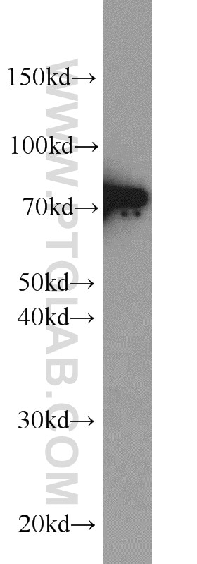 Western Blot (WB) analysis of K-562 cells using DNAJC2/MPP11 Polyclonal antibody (11971-1-AP)