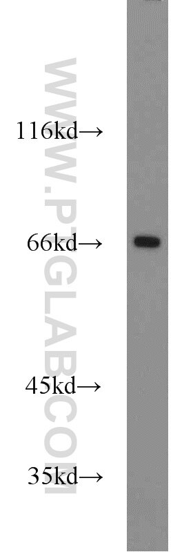Western Blot (WB) analysis of mouse liver tissue using DNAJC2/MPP11 Polyclonal antibody (11971-1-AP)