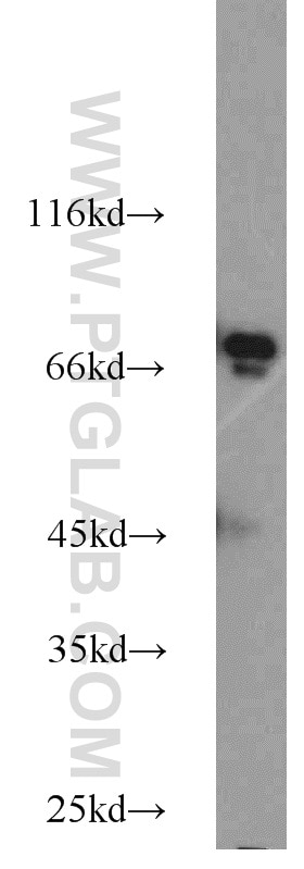 Western Blot (WB) analysis of HeLa cells using DNAJC2/MPP11 Polyclonal antibody (11971-1-AP)