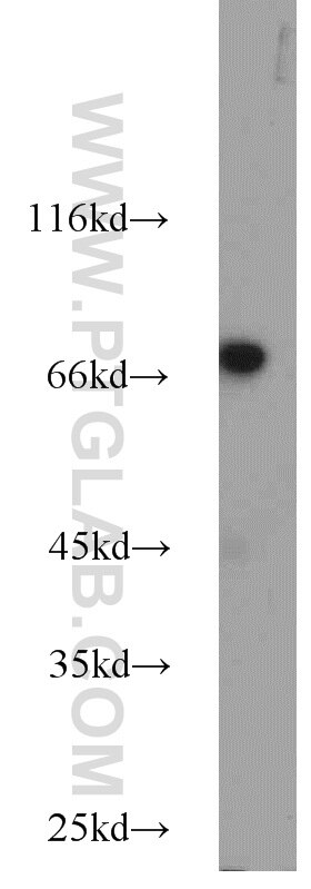 WB analysis of HeLa using 11971-1-AP