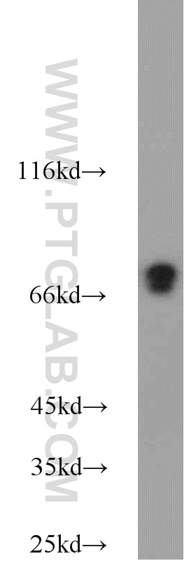 Western Blot (WB) analysis of K-562 cells using DNAJC2/MPP11 Polyclonal antibody (11971-1-AP)