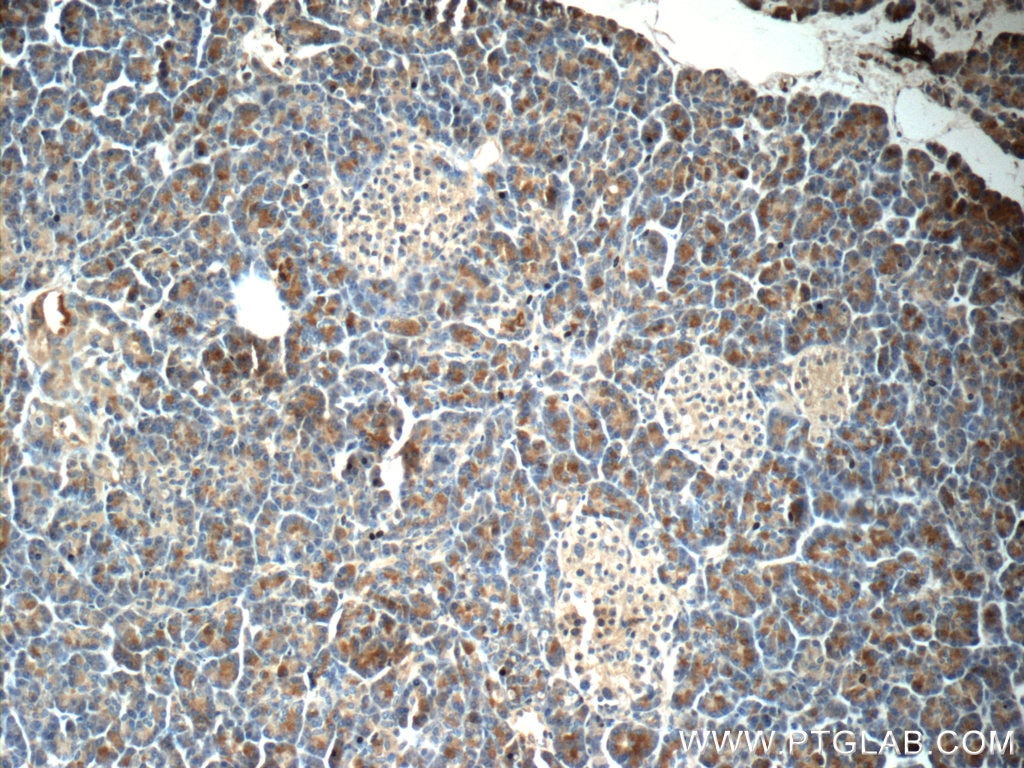 Immunohistochemistry (IHC) staining of human pancreas tissue using DNAJC21 Polyclonal antibody (23411-1-AP)