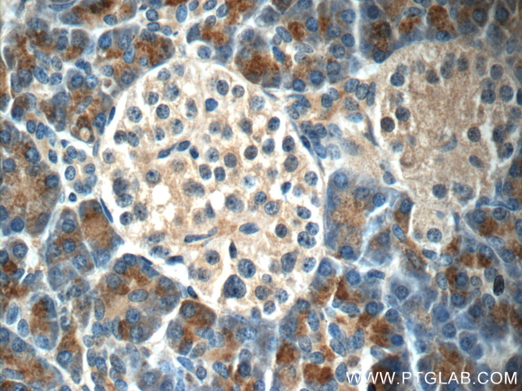 Immunohistochemistry (IHC) staining of human pancreas tissue using DNAJC21 Polyclonal antibody (23411-1-AP)