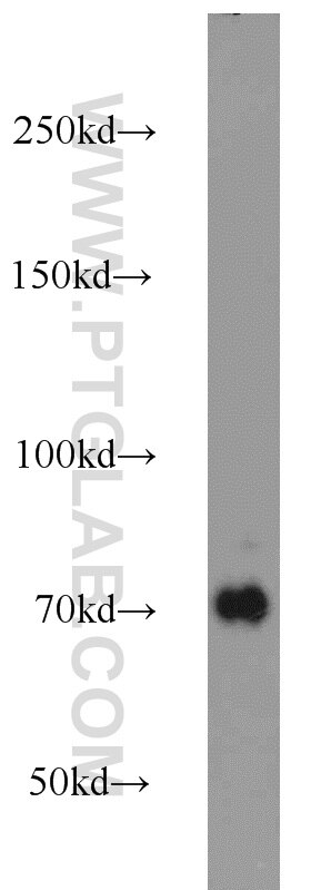 Western Blot (WB) analysis of mouse brain tissue using DNAJC21 Polyclonal antibody (23411-1-AP)