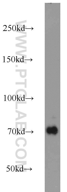 WB analysis of mouse brain using 23411-1-AP