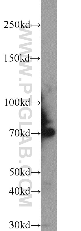 Western Blot (WB) analysis of rat brain tissue using DNAJC21 Polyclonal antibody (23411-1-AP)