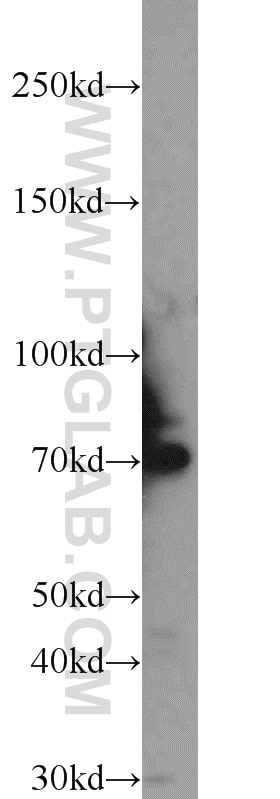 WB analysis of rat brain using 23411-1-AP