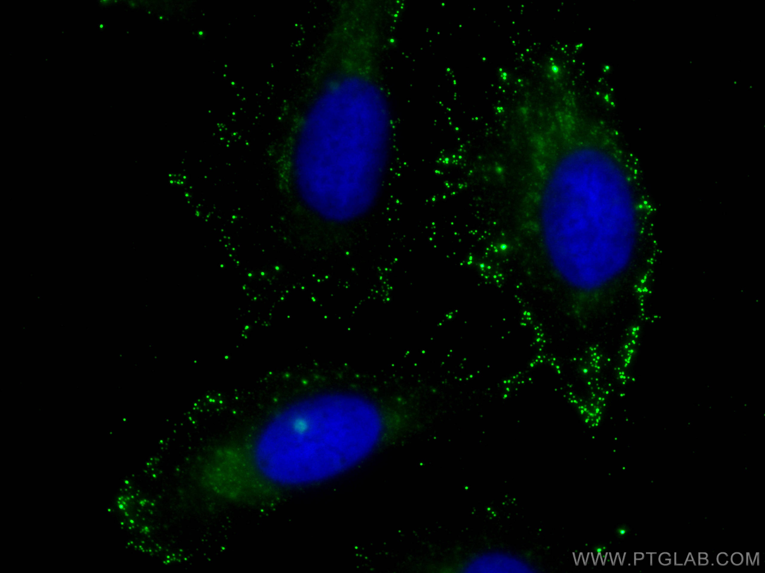 IF Staining of U2OS using 68343-1-Ig