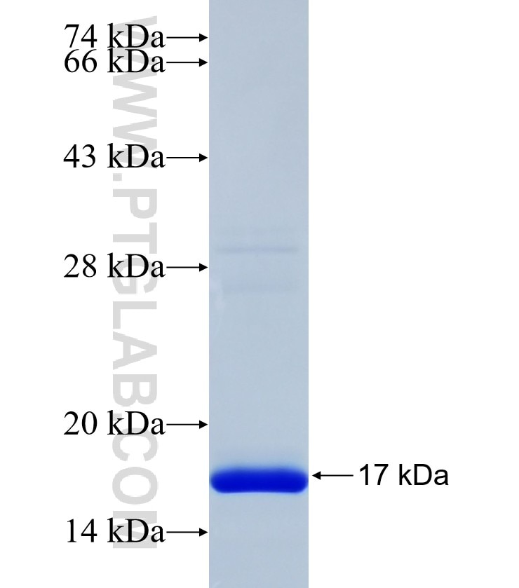 DNAJC22 fusion protein Ag38322 SDS-PAGE DNAJC22 fusion protein Ag38322 SDS-PAGE