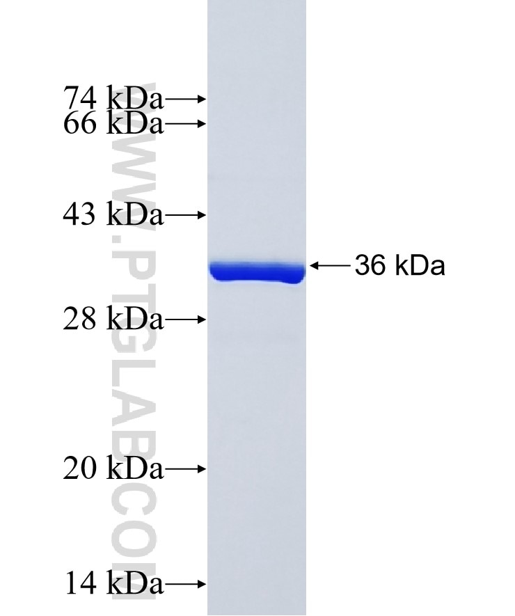 DNAJC22 fusion protein Ag38522 SDS-PAGE