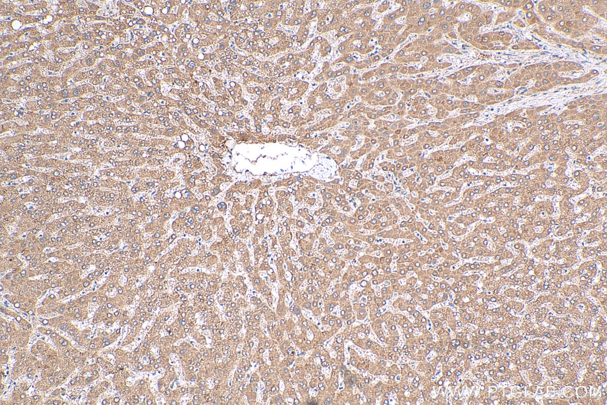 Immunohistochemistry (IHC) staining of human liver tissue using DNAJC25 Polyclonal antibody (26229-1-AP)