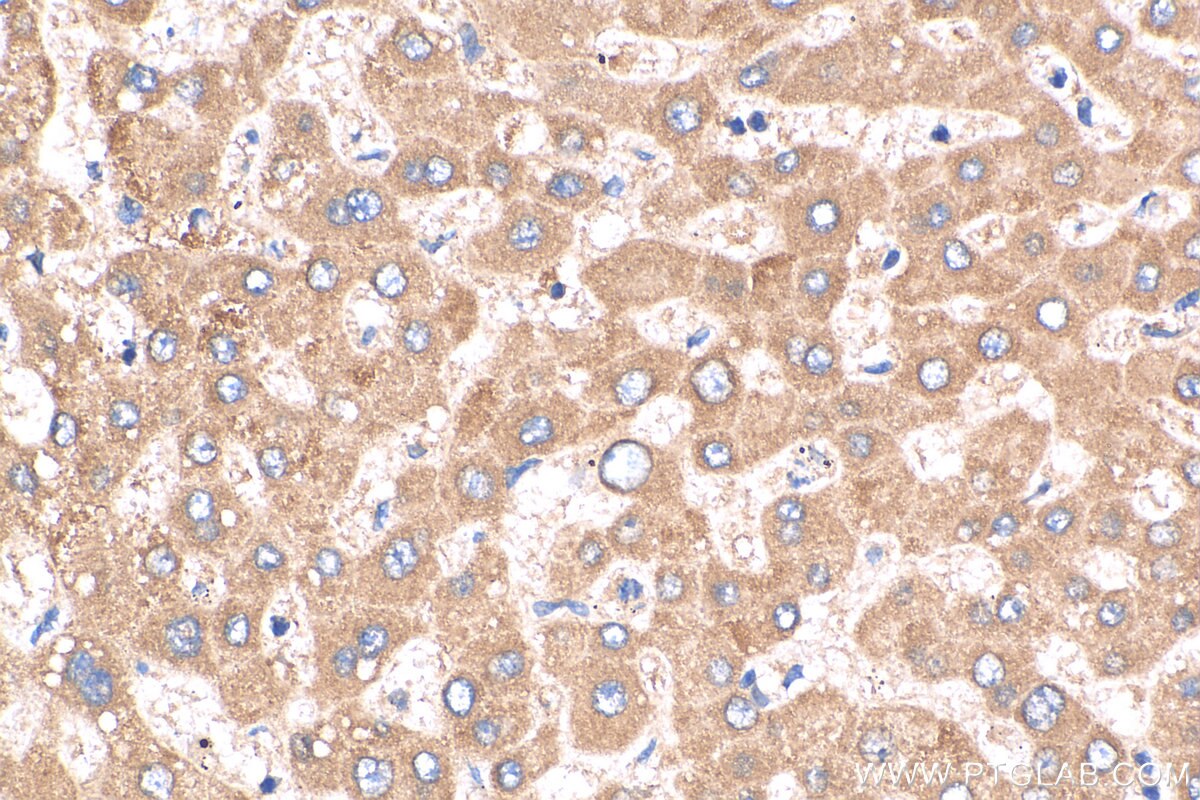 Immunohistochemistry (IHC) staining of human liver tissue using DNAJC25 Polyclonal antibody (26229-1-AP)