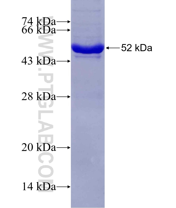DNAJC27 fusion protein Ag10586 SDS-PAGE