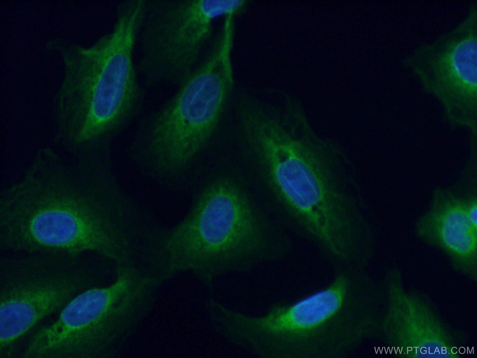 Immunofluorescence (IF) / fluorescent staining of U2OS cells using DNAJC3 Polyclonal antibody (26721-1-AP)