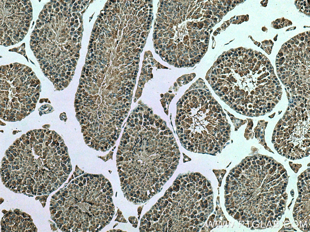 Immunohistochemistry (IHC) staining of mouse testis tissue using DNAJC3 Polyclonal antibody (26721-1-AP)