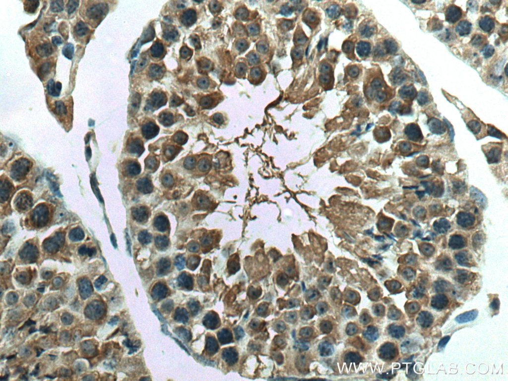 Immunohistochemistry (IHC) staining of mouse testis tissue using DNAJC3 Polyclonal antibody (26721-1-AP)