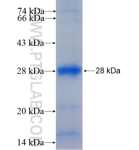 DNAJC30 fusion protein Ag15207 SDS-PAGE
