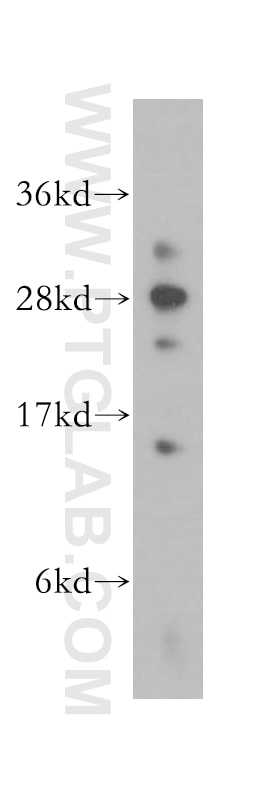 Western Blot (WB) analysis of HeLa cells using DNAJC4 Polyclonal antibody (13853-1-AP)