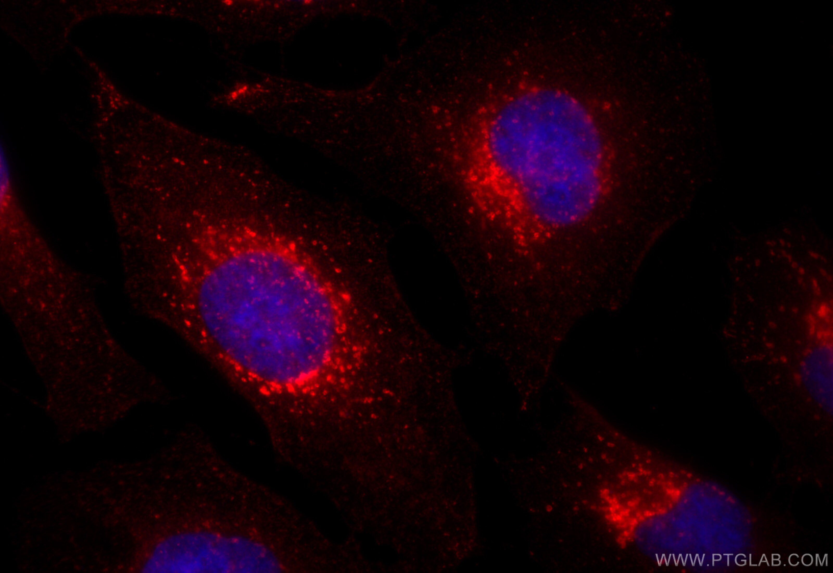 Immunofluorescence (IF) / fluorescent staining of HeLa cells using DNAJC5 Polyclonal antibody (32204-1-AP)