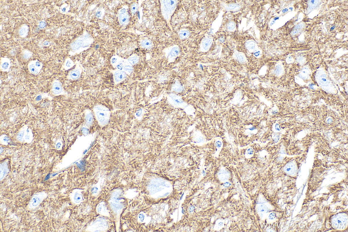 Immunohistochemistry (IHC) staining of mouse cerebellum tissue using DNAJC5 Polyclonal antibody (32204-1-AP)