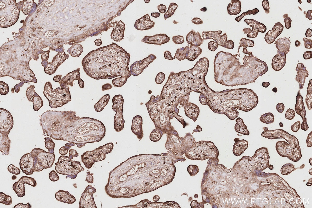 Immunohistochemistry (IHC) staining of human placenta tissue using DNAJC5 Polyclonal antibody (32204-1-AP)