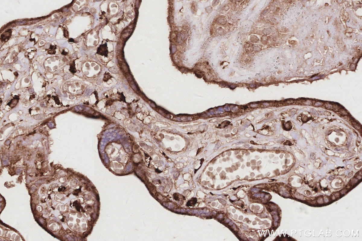 Immunohistochemistry (IHC) staining of human placenta tissue using DNAJC5 Polyclonal antibody (32204-1-AP)