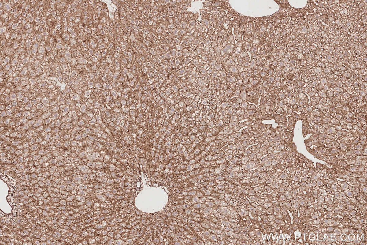 IHC staining of mouse liver using 32204-1-AP Immunohistochemistry (IHC) staining of mouse liver tissue using DNAJC5 Polyclonal antibody (32204-1-AP)