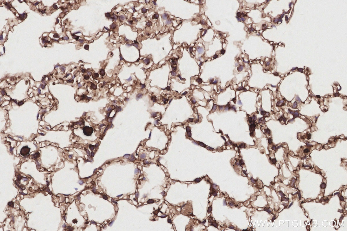 Immunohistochemistry (IHC) staining of mouse lung tissue using DNAJC5 Polyclonal antibody (32204-1-AP)