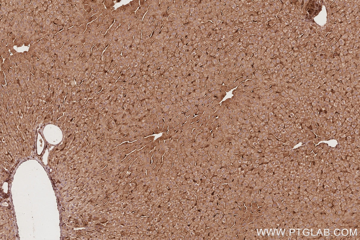 IHC staining of rat liver using 32204-1-AP Immunohistochemistry (IHC) staining of rat liver tissue using DNAJC5 Polyclonal antibody (32204-1-AP)