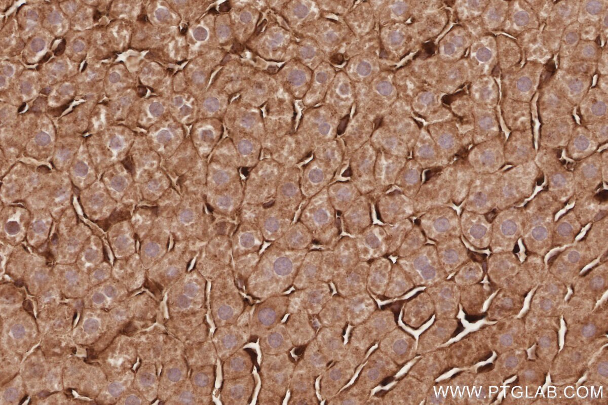 Immunohistochemistry (IHC) staining of rat liver tissue using DNAJC5 Polyclonal antibody (32204-1-AP)