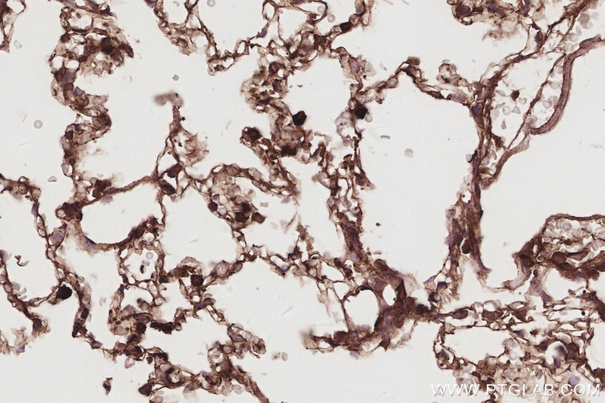 IHC staining of rat lung using 32204-1-AP Immunohistochemistry (IHC) staining of rat lung tissue using DNAJC5 Polyclonal antibody (32204-1-AP)