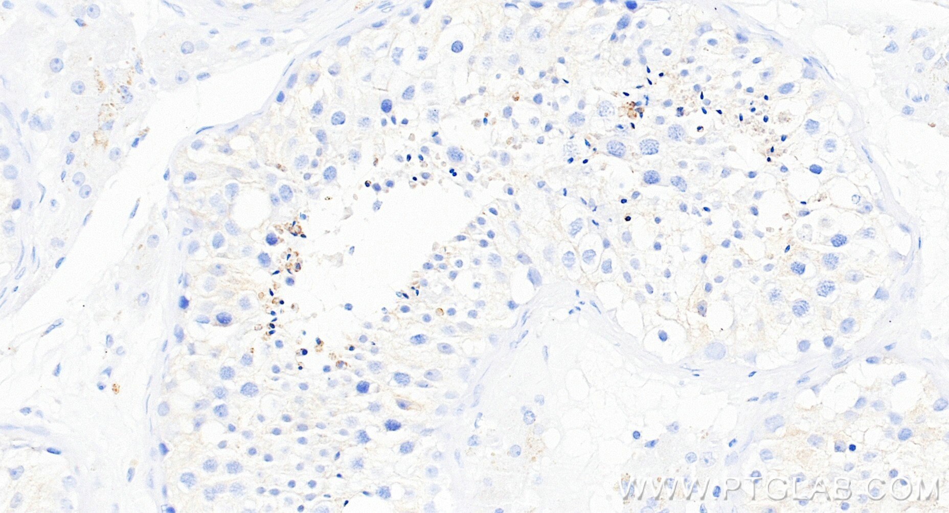 IHC staining of human testis using 86975-4-RR (same clone as 86975-4-PBS) Immunohistochemistry (IHC) staining of human testis tissue using DNAJC5B Recombinant monoclonal antibody (86975-4-RR)