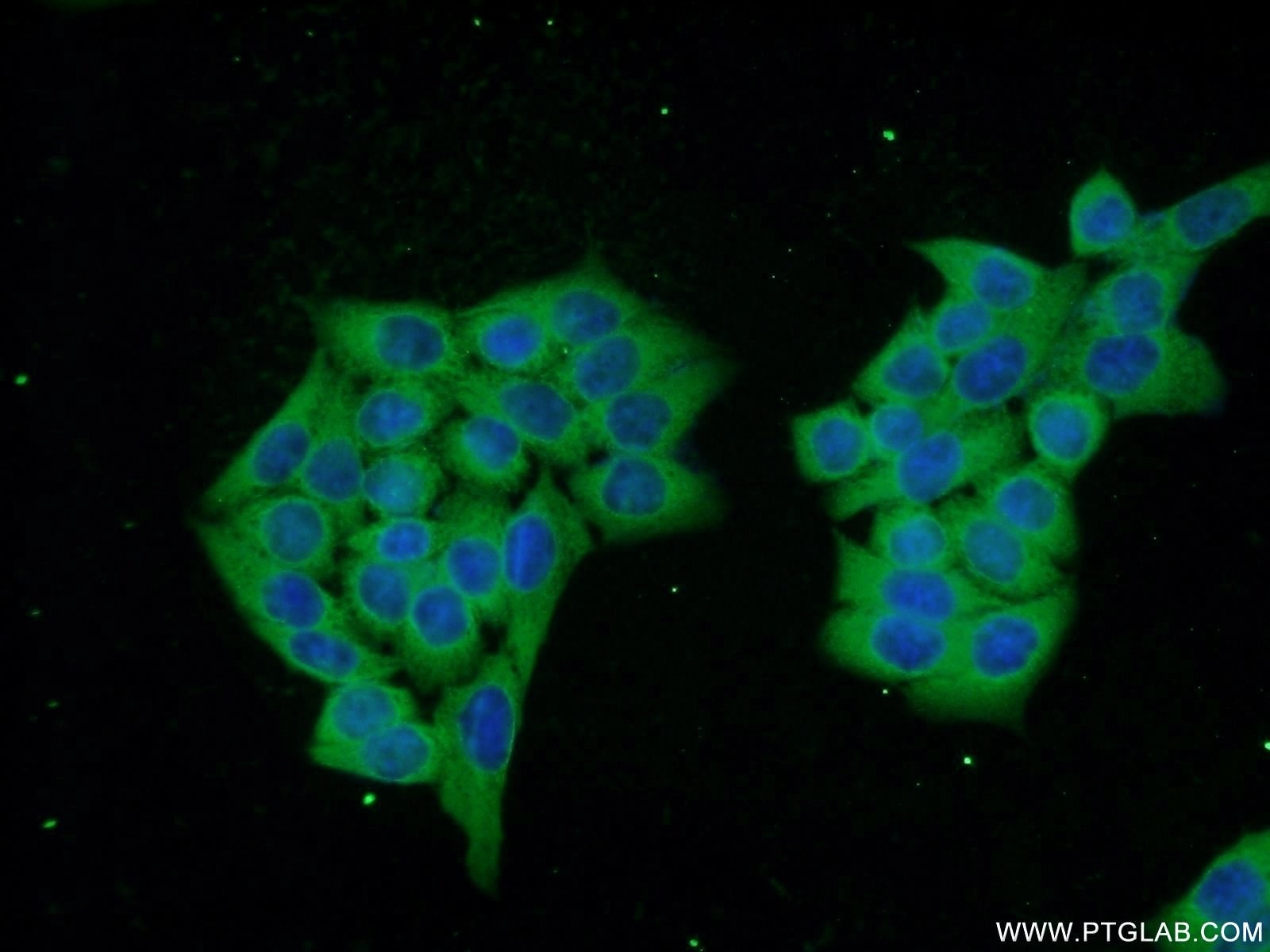 Immunofluorescence (IF) / fluorescent staining of HeLa cells using DNAJC6/AUXILIN Polyclonal antibody (21941-1-AP)
