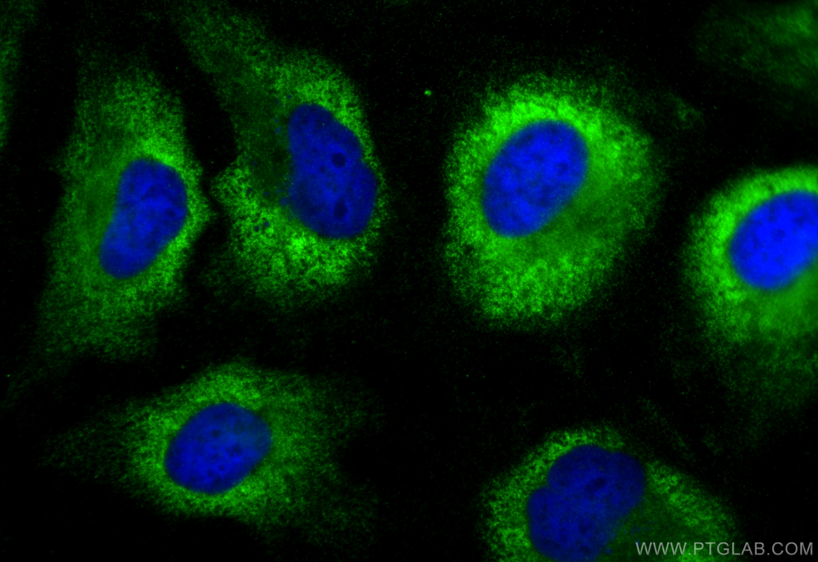 Immunofluorescence (IF) / fluorescent staining of HeLa cells using DNAJC6/AUXILIN Polyclonal antibody (21941-1-AP)