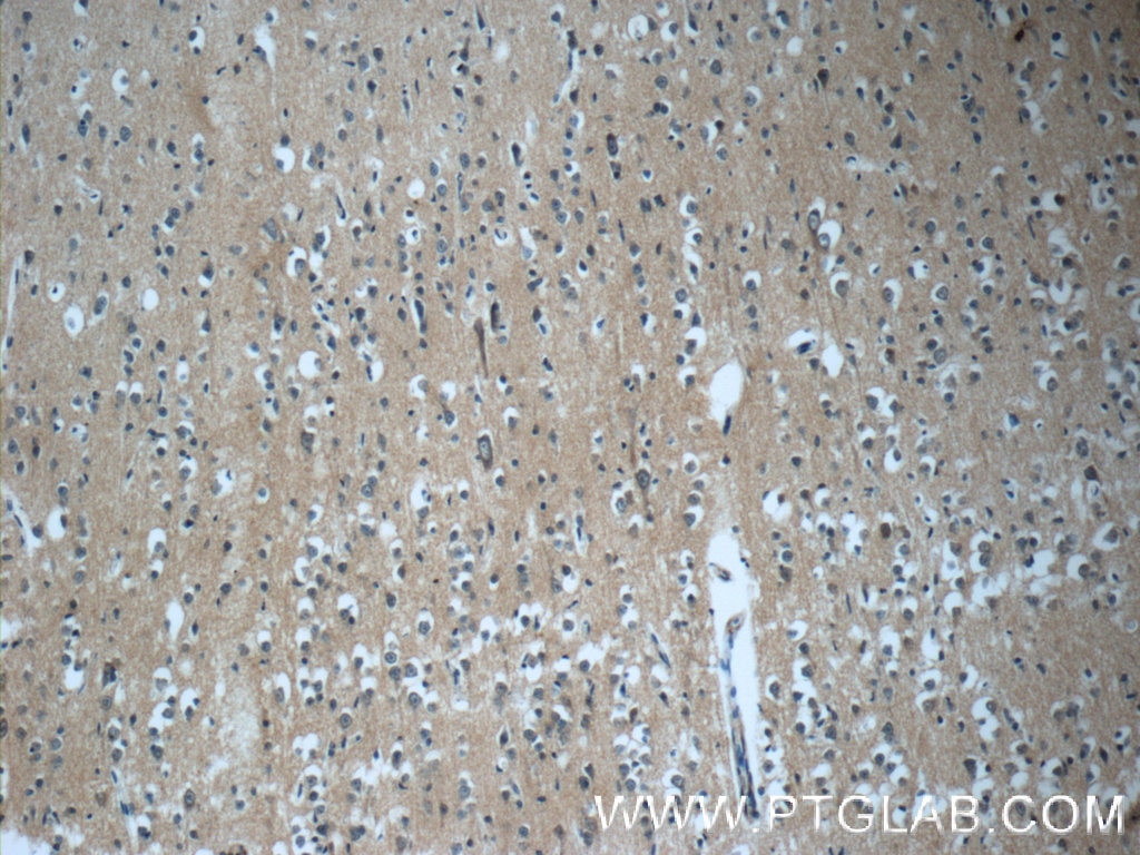 Immunohistochemistry (IHC) staining of human brain tissue using DNAJC6/AUXILIN Polyclonal antibody (21941-1-AP)
