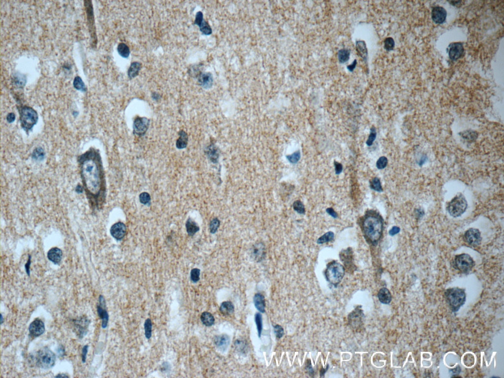 Immunohistochemistry (IHC) staining of human brain tissue using DNAJC6/AUXILIN Polyclonal antibody (21941-1-AP)