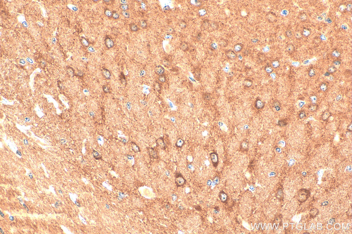 Immunohistochemistry (IHC) staining of mouse brain tissue using DNAJC6/AUXILIN Polyclonal antibody (21941-1-AP)