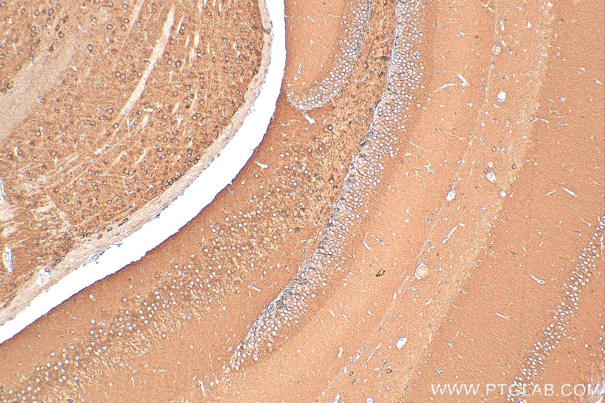 Immunohistochemistry (IHC) staining of mouse brain tissue using DNAJC6/AUXILIN Polyclonal antibody (21941-1-AP)