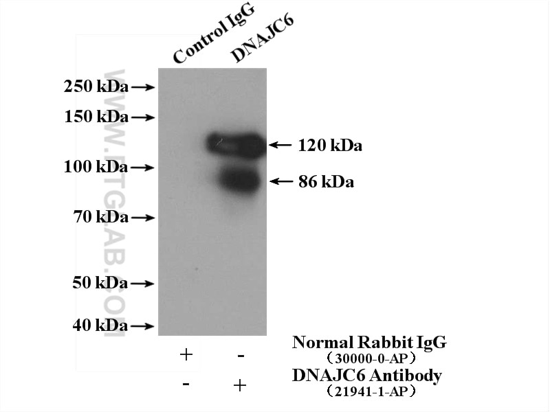 Immunoprecipitation (IP) experiment of mouse brain tissue using DNAJC6/AUXILIN Polyclonal antibody (21941-1-AP)