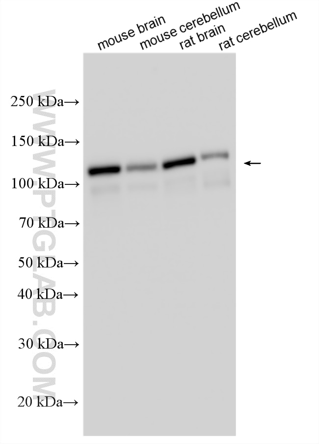 Western Blot (WB) analysis of various lysates using DNAJC6/AUXILIN Polyclonal antibody (21941-1-AP)