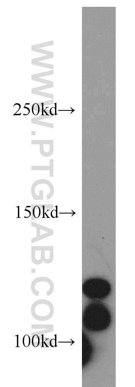 DNAJC6/AUXILIN