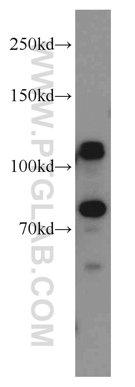 Western Blot (WB) analysis of HeLa cells using DNAJC6/AUXILIN Polyclonal antibody (21941-1-AP)