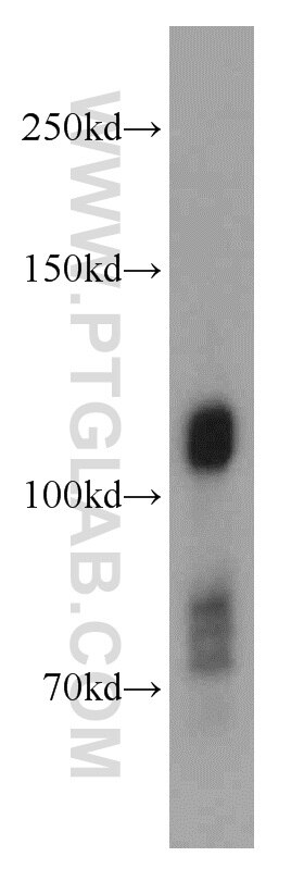 Western Blot (WB) analysis of human brain tissue using DNAJC6/AUXILIN Polyclonal antibody (21941-1-AP)