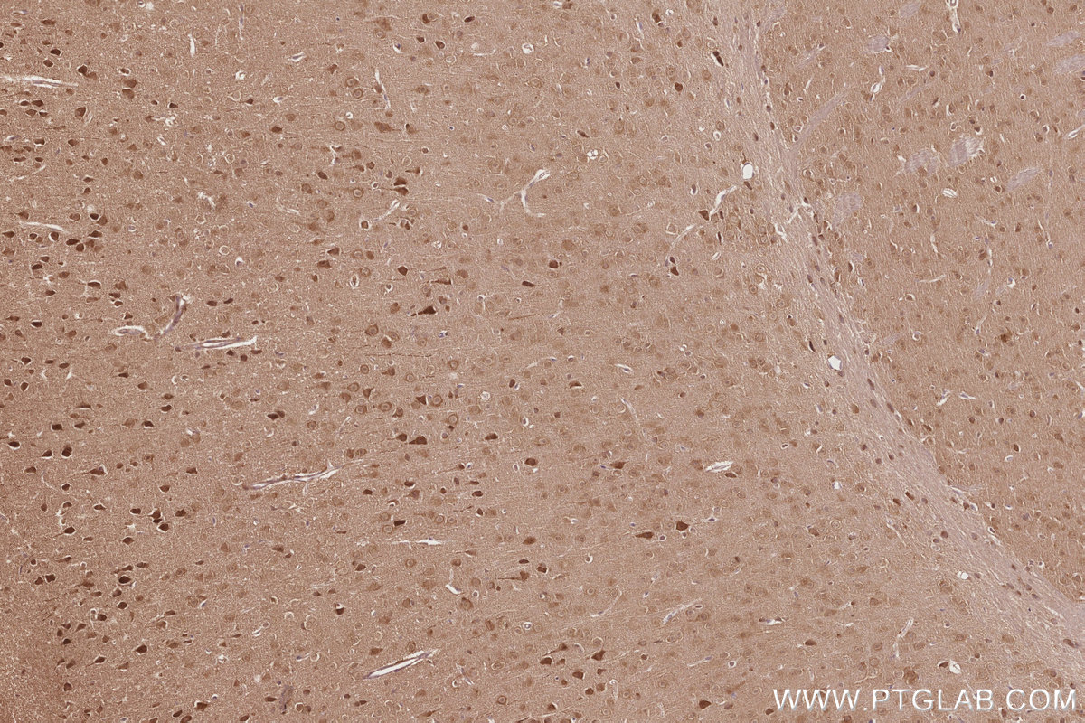 Immunohistochemistry (IHC) staining of mouse brain tissue using DNAJC7 Polyclonal antibody (11090-1-AP)