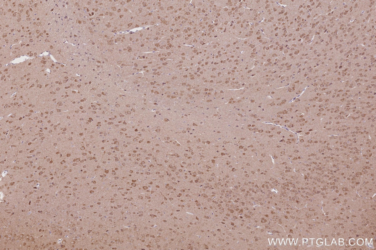 Immunohistochemistry (IHC) staining of rat brain tissue using DNAJC7 Polyclonal antibody (11090-1-AP)