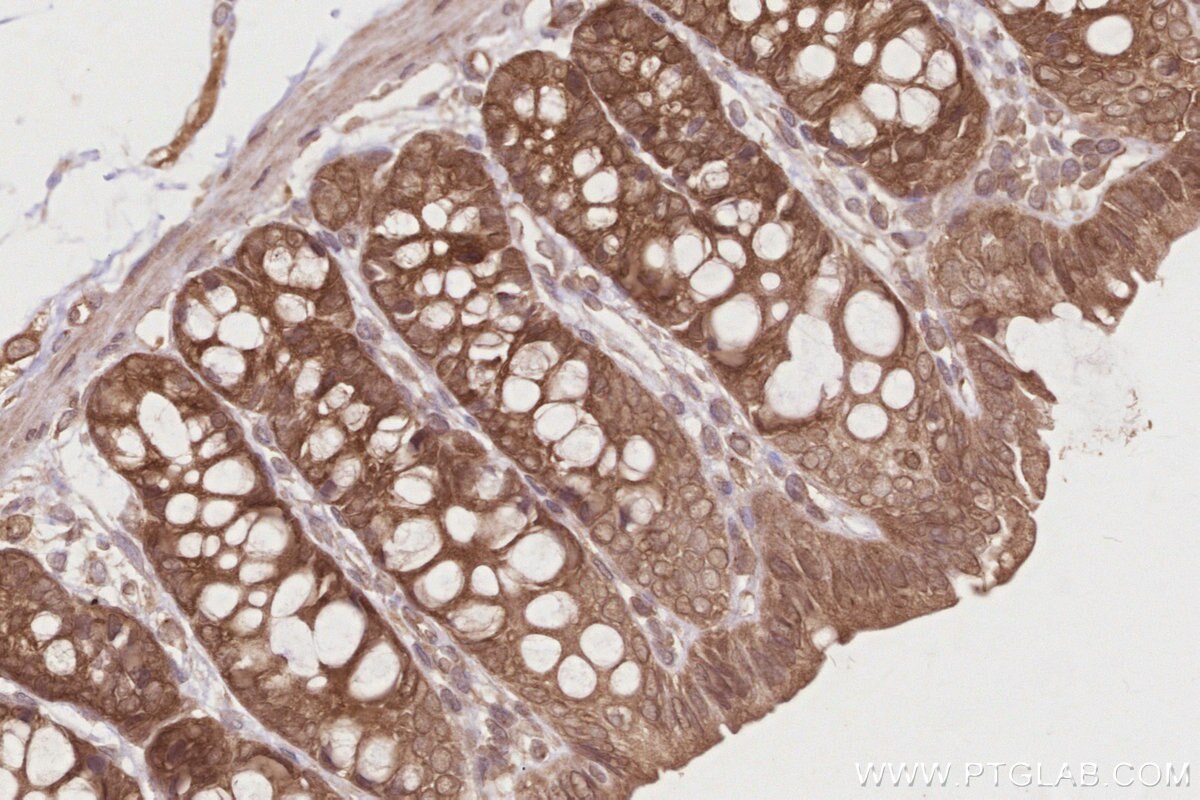 Immunohistochemistry (IHC) staining of rat colon tissue using DNAJC7 Polyclonal antibody (11090-1-AP)