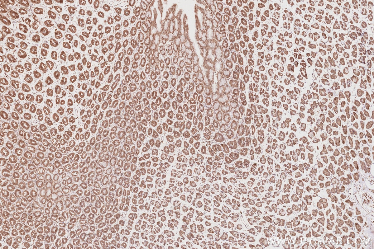 Immunohistochemistry (IHC) staining of rat stomach tissue using DNAJC7 Polyclonal antibody (11090-1-AP)