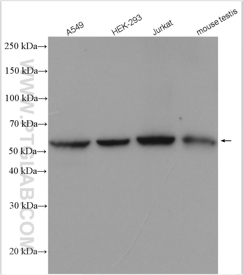 Western Blot (WB) analysis of various lysates using DNAJC7 Polyclonal antibody (11090-1-AP)